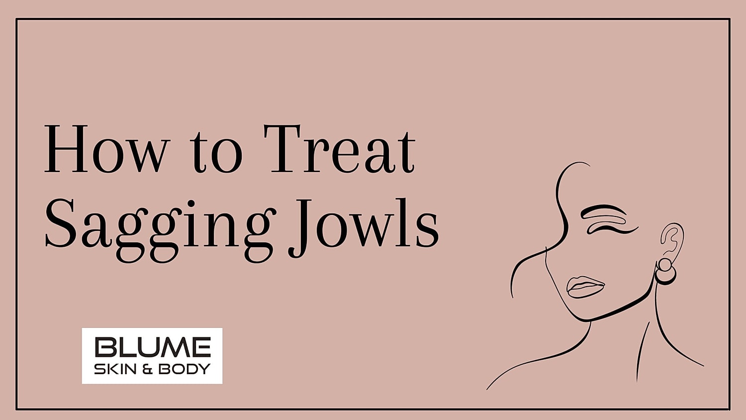 How to Treat Sagging Jowls