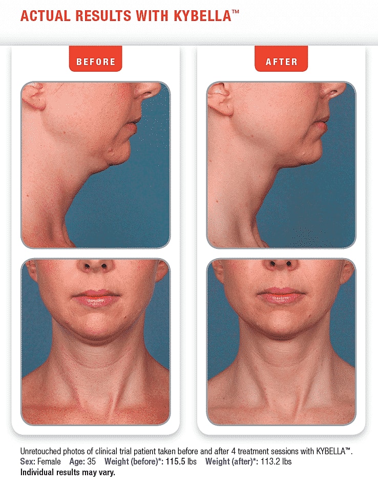 Screen Shot 2015-09-13 at 12.38.50 PM