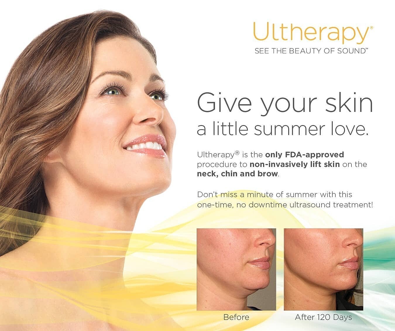 My Ultherapy Experience