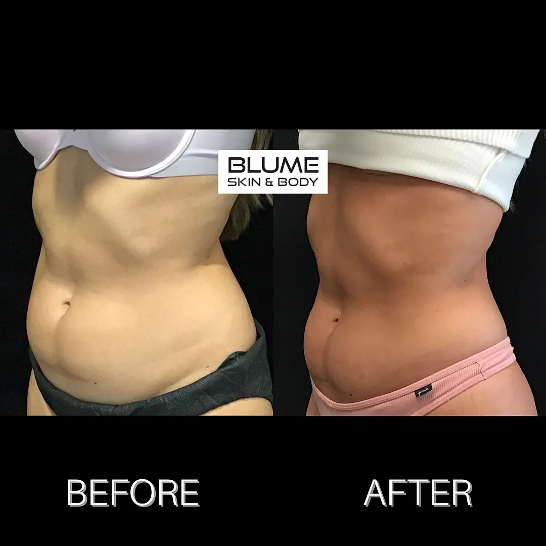 Before and after body transformation comparison image.