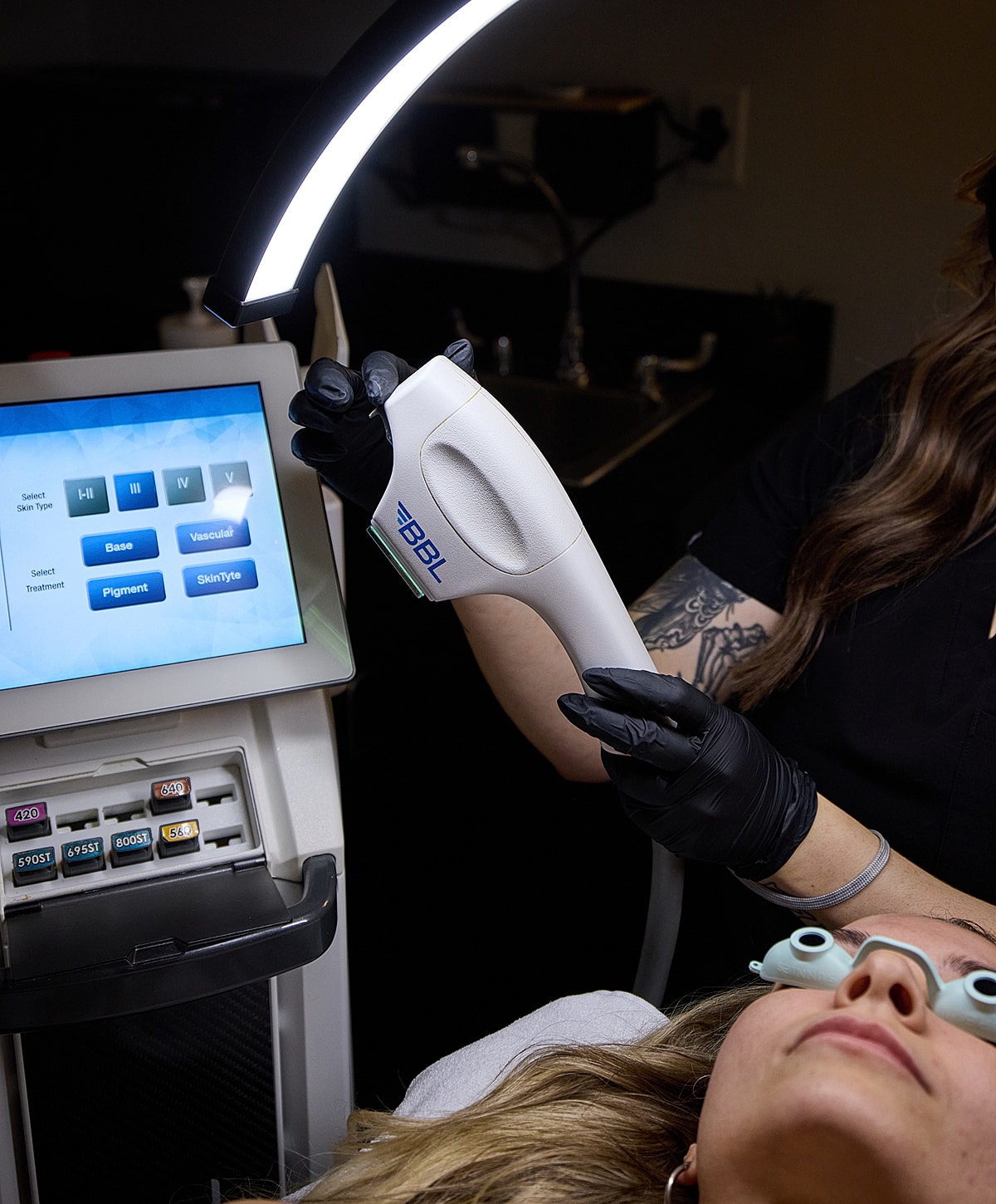 BBL treatment procedure in a skincare clinic.