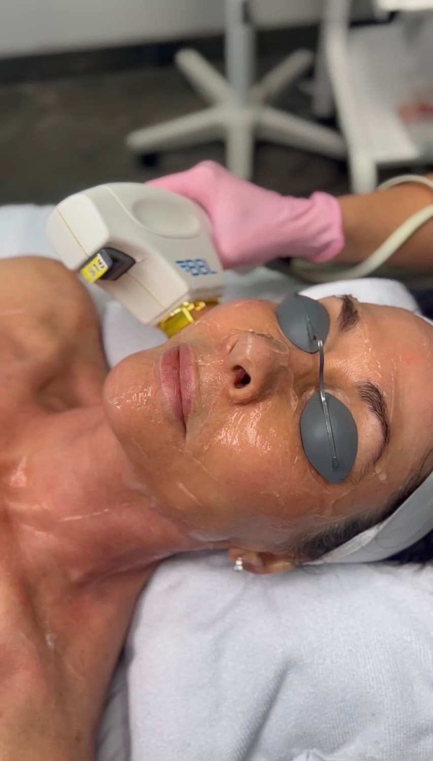 Facial treatment with laser device in progress.