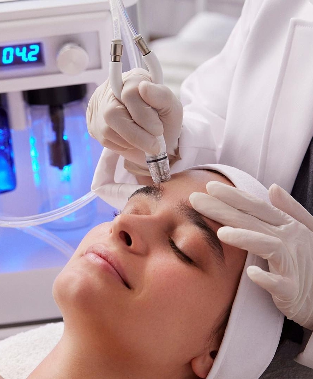 Facial treatment with microdermabrasion device.