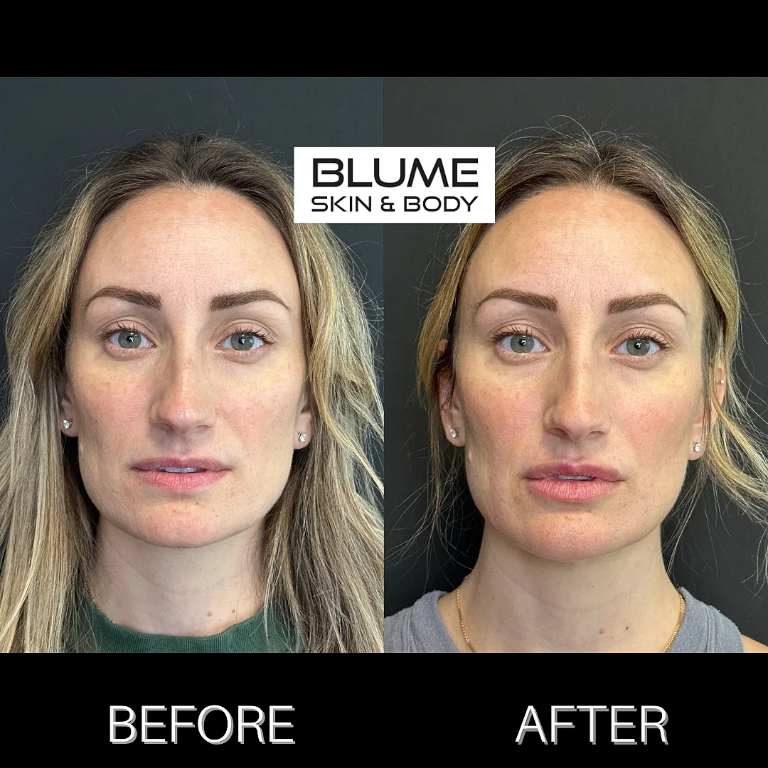 Skin treatment before and after results.