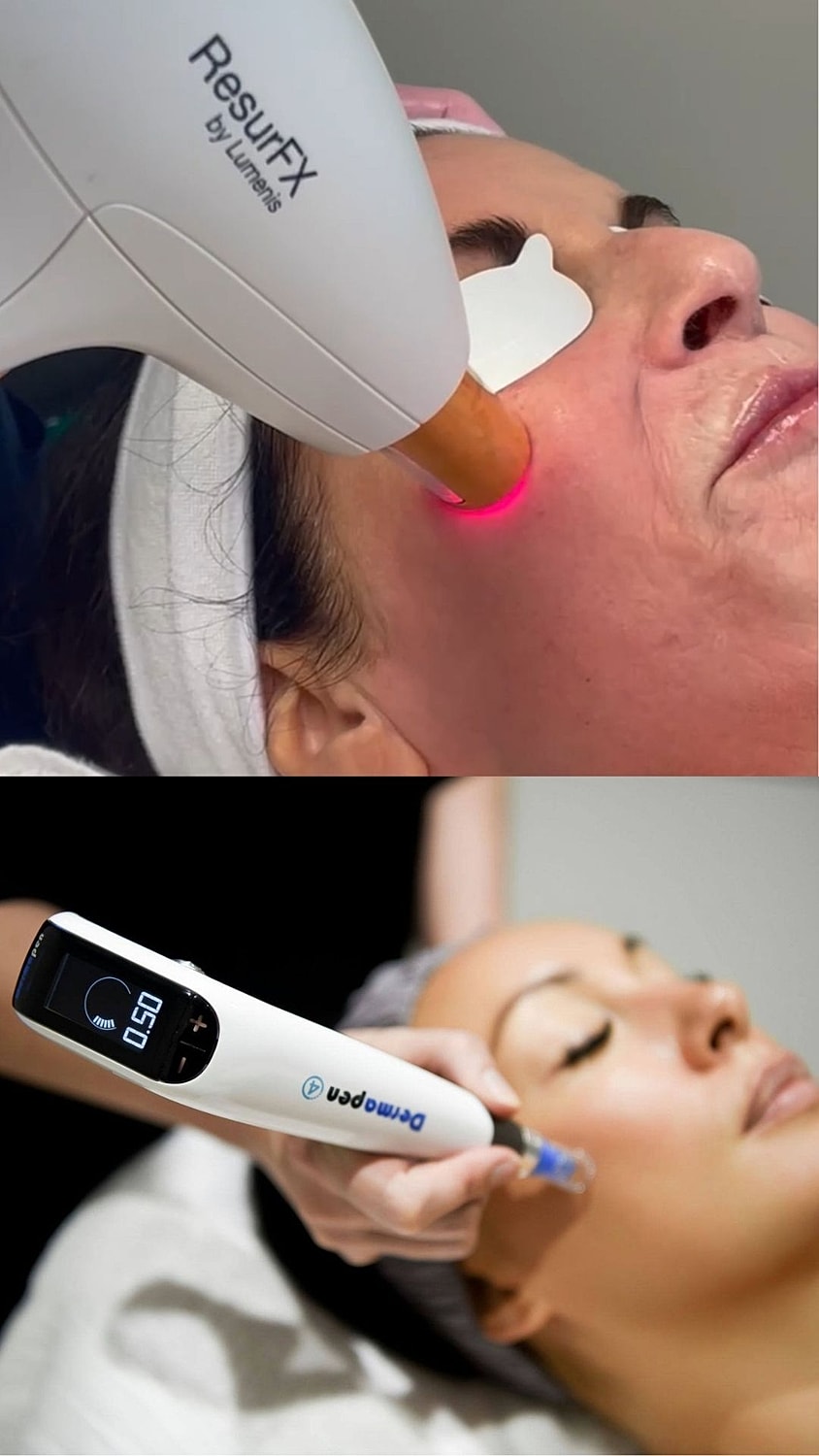 Skincare treatments with advanced technology devices.
