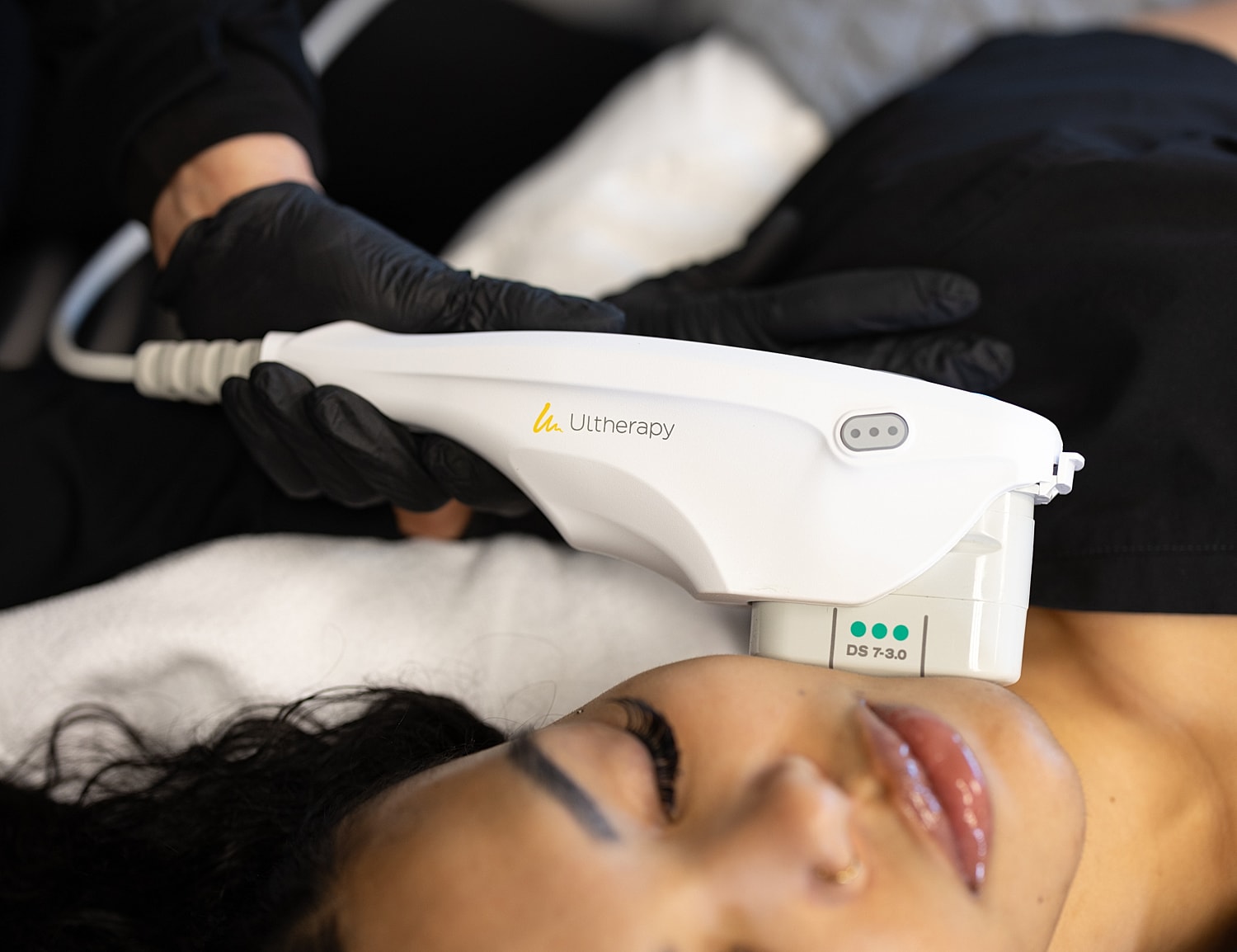 Ultherapy facial treatment in progress on client.