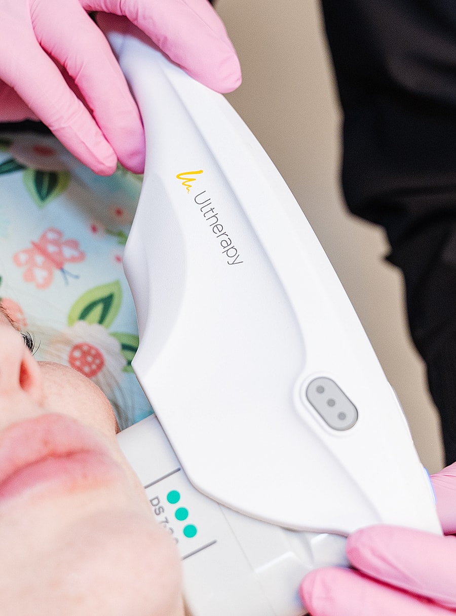 Ultherapy treatment using medical device on patient