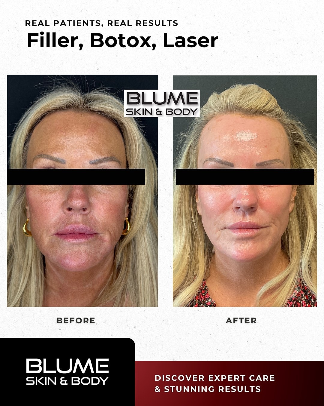 Before and after cosmetic treatment results.