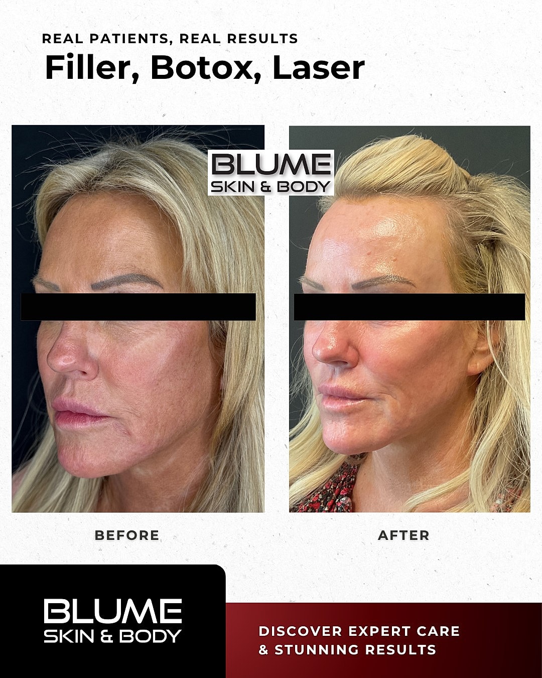 Before and after aesthetic treatment results
