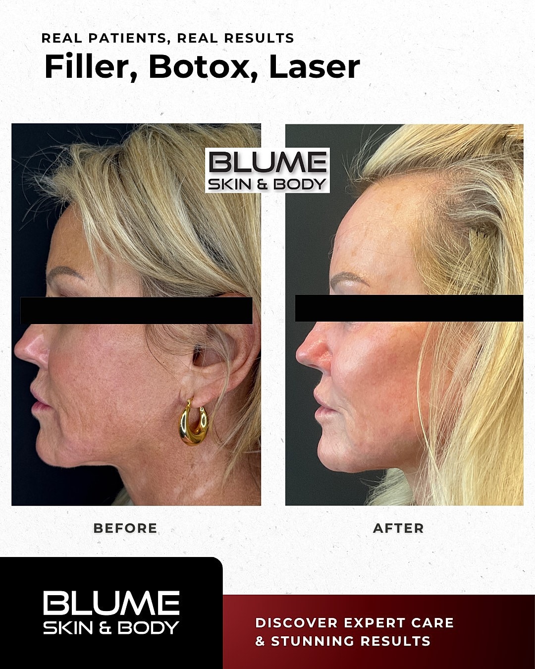 Before and after cosmetic treatment results.
