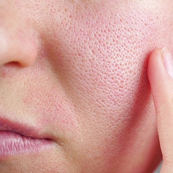 Close-up of skin texture and pores.