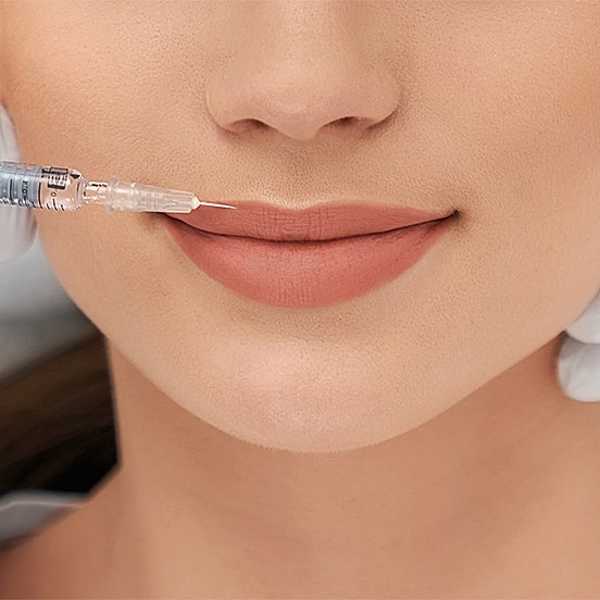 Woman receiving lip filler injection treatment.