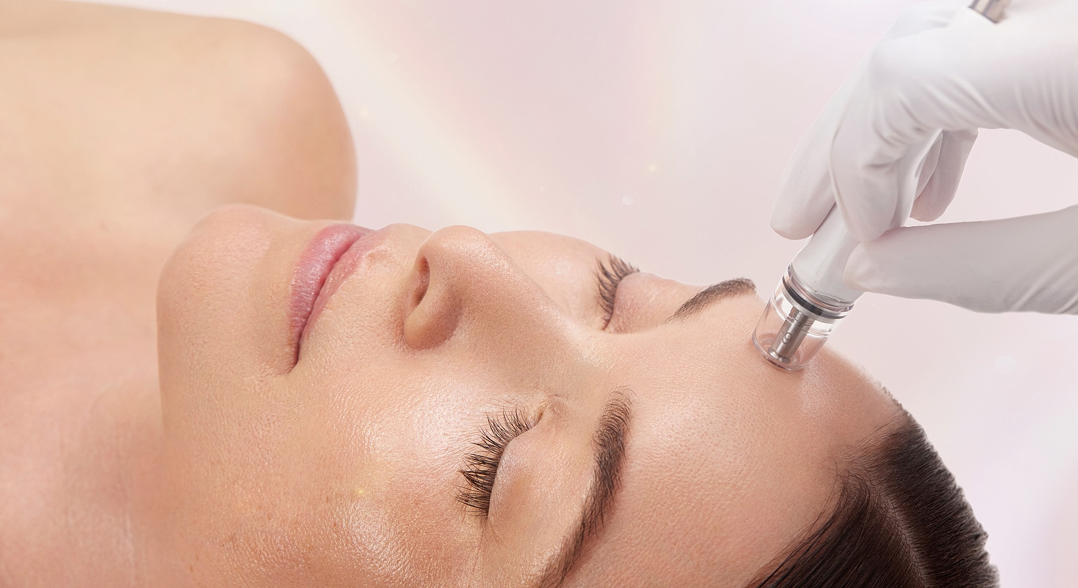 Microneedling treatment on a woman's forehead.