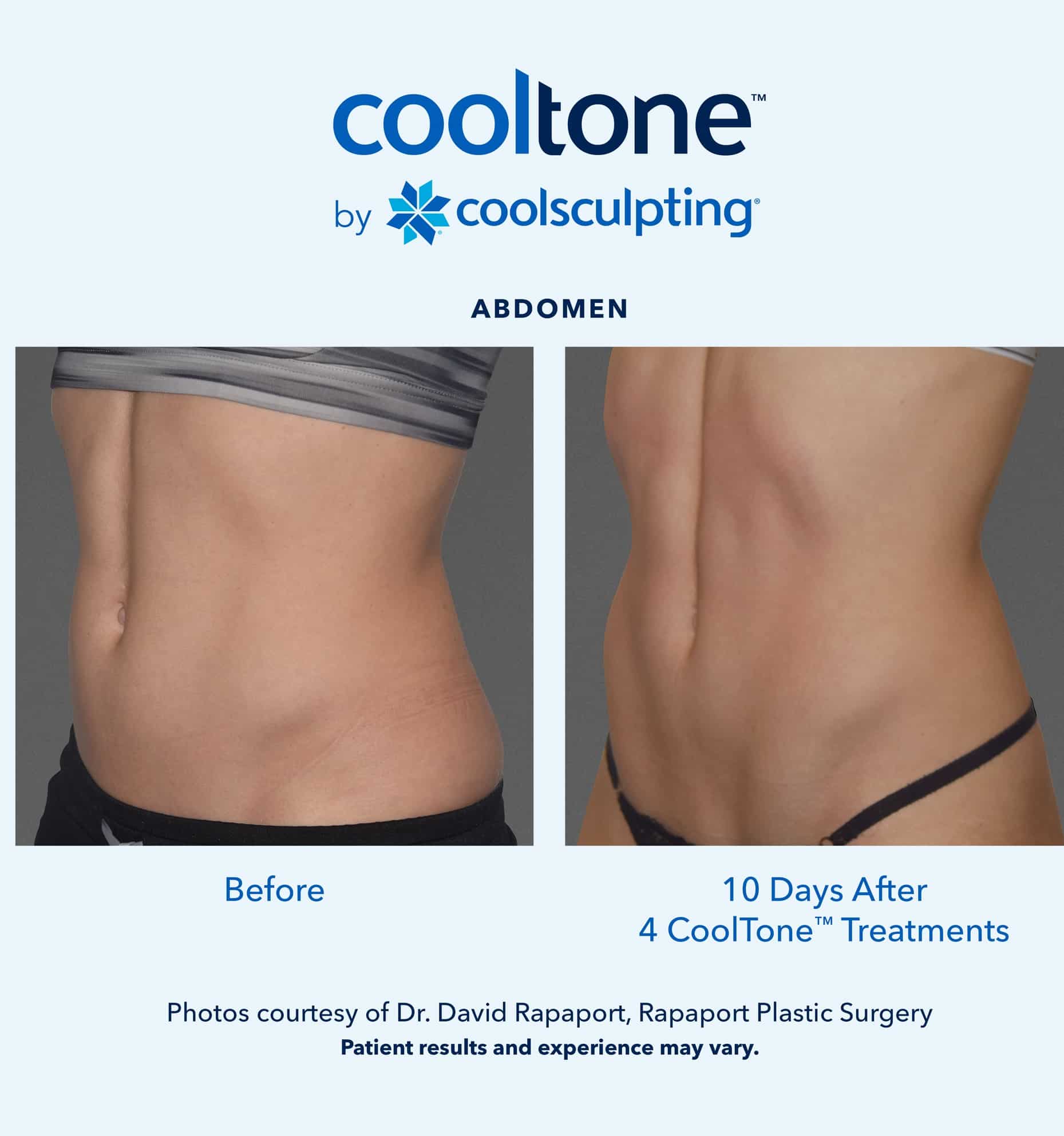 CoolSculpting & CoolTone - New Decade New You - BLUME
