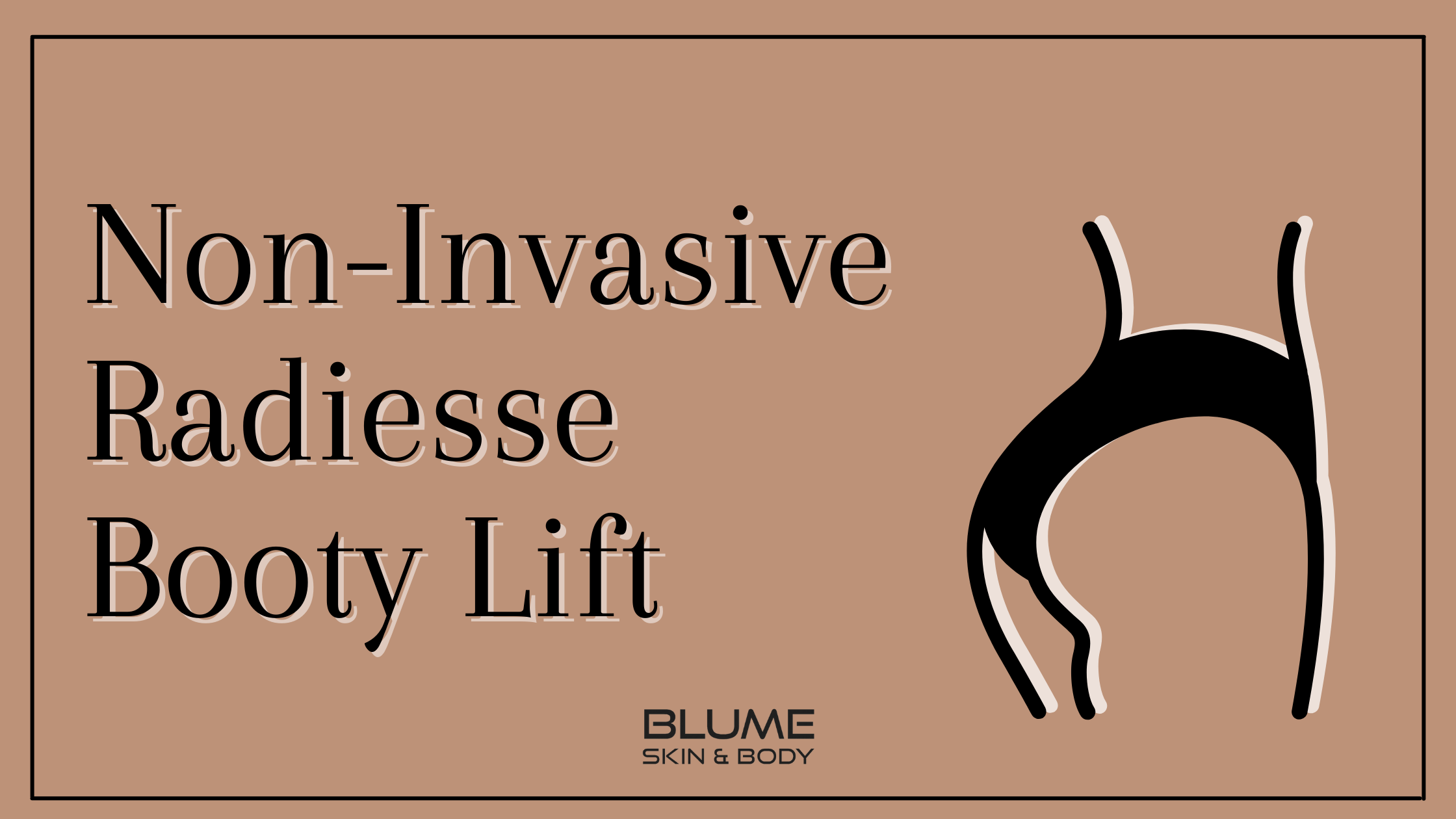 Non-Surgical Butt Lift with Radiesse 
